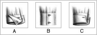 Cuff types ABC