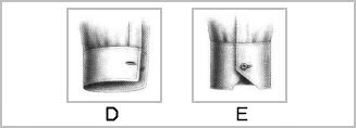 Cuff types DE